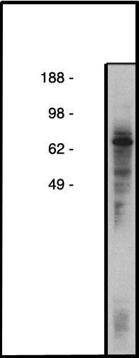 "
Western blot using CERTL antibody (Cat. No. X2089P) on HT-29 cell lysate (28 µg/lane).  Primary antibody used at 10µg/ml.  Secondary antibody, mouse anti-rabbit HRP (Cat. No. X1207M), used at 1:50k."